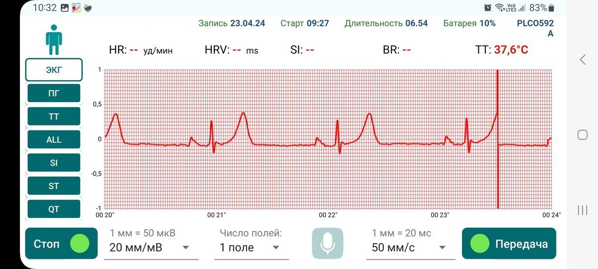 Приложение DH-CardioPatch: ЭКГ и показатели на экране смартфона