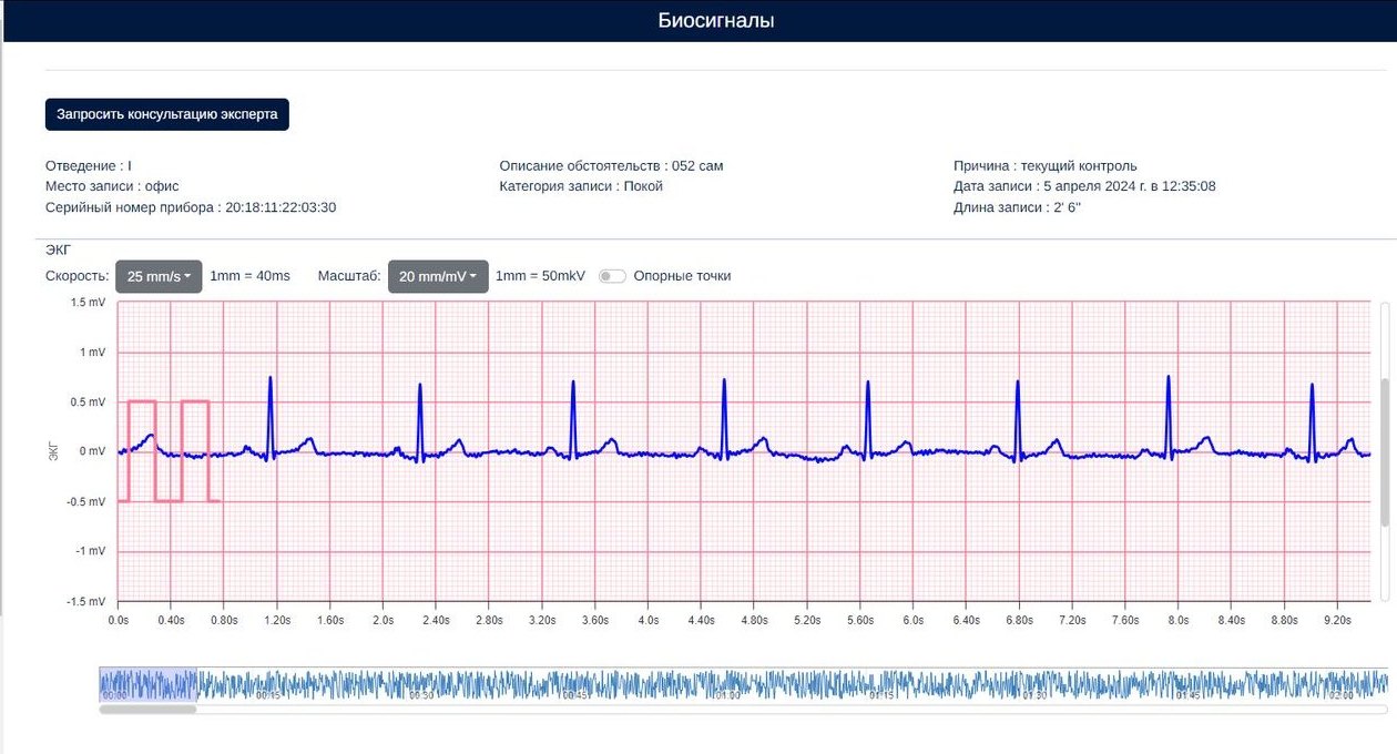 Портал Delfihealth Telemed: ЭКГ на миллиметровой ленте